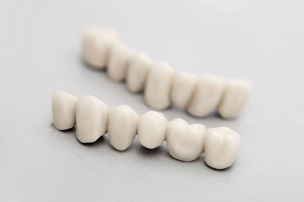 porcelain dental crowns tulsa