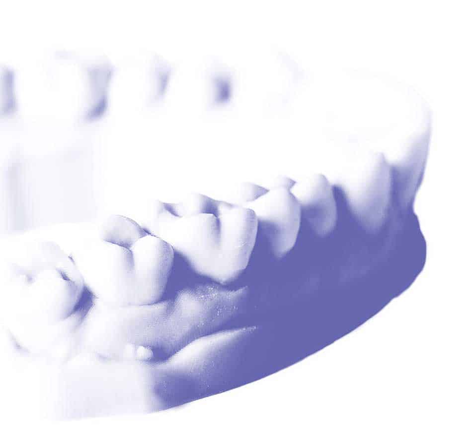 IDA Custom Shade Area Dental Crown Mold