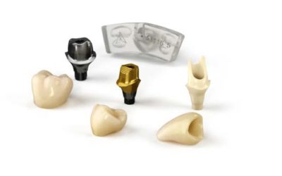 The Evolution of Single Tooth Implant-Supported Restorations