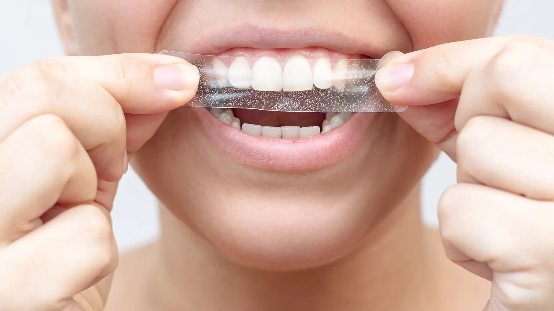 Top 10 Teeth Whitening Products of 2025