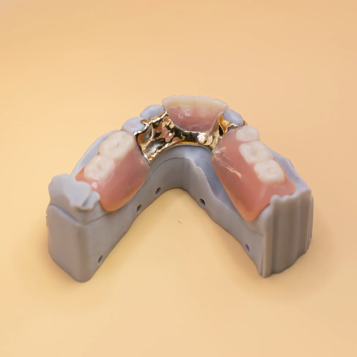 Acrylic interim partial denture at the IDA bench