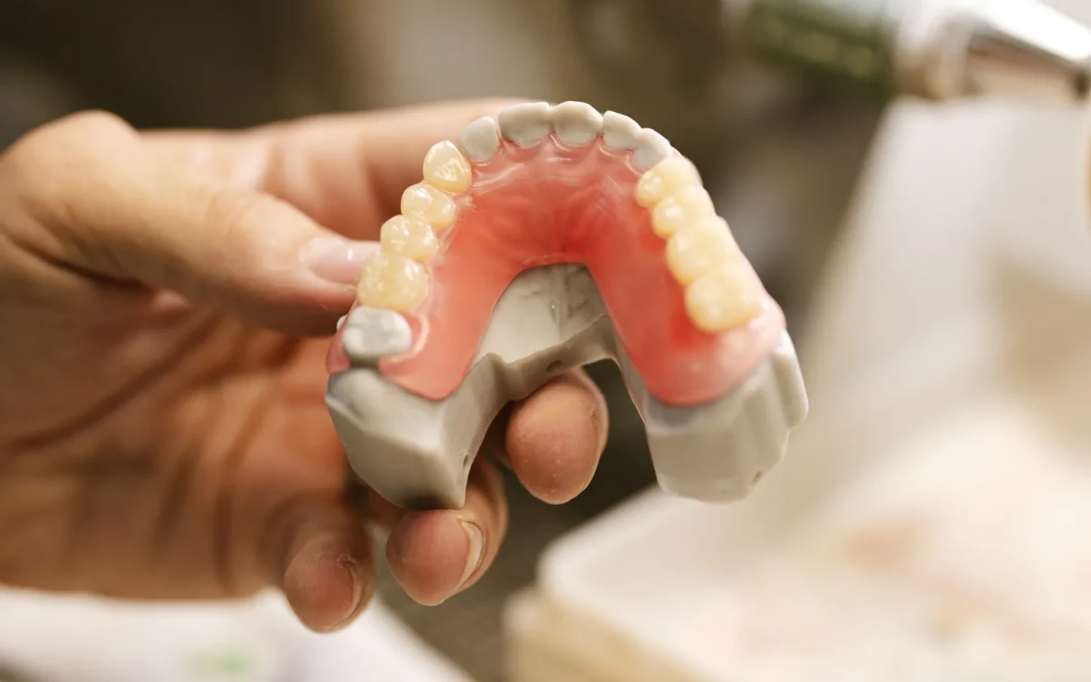 Cast partial denture frame on master cast