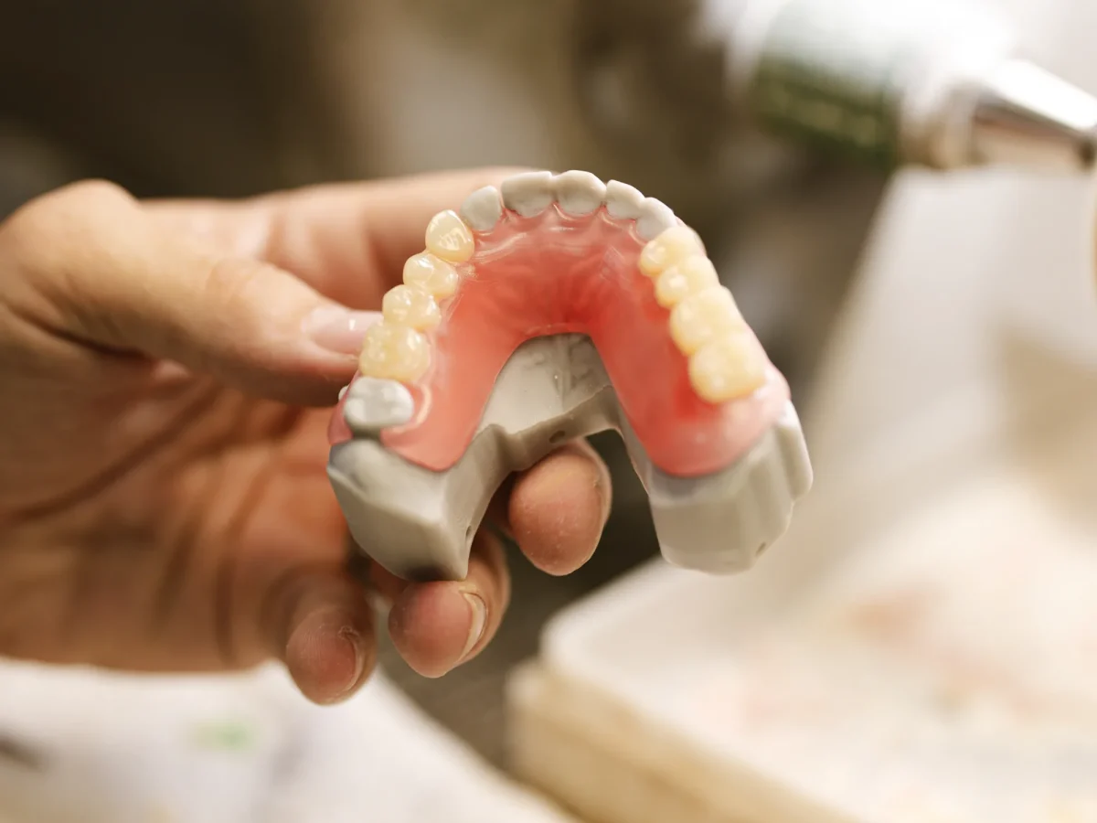 Cast partial denture frame on master cast