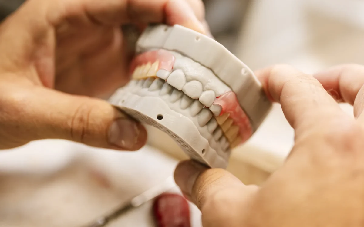 Articulated complete denture, upper and lower, at the IDA bench