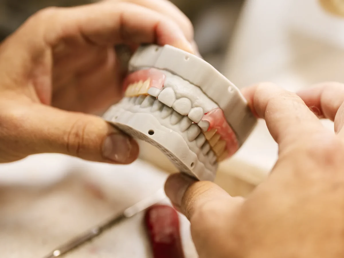 Articulated complete denture, upper and lower, at the IDA bench