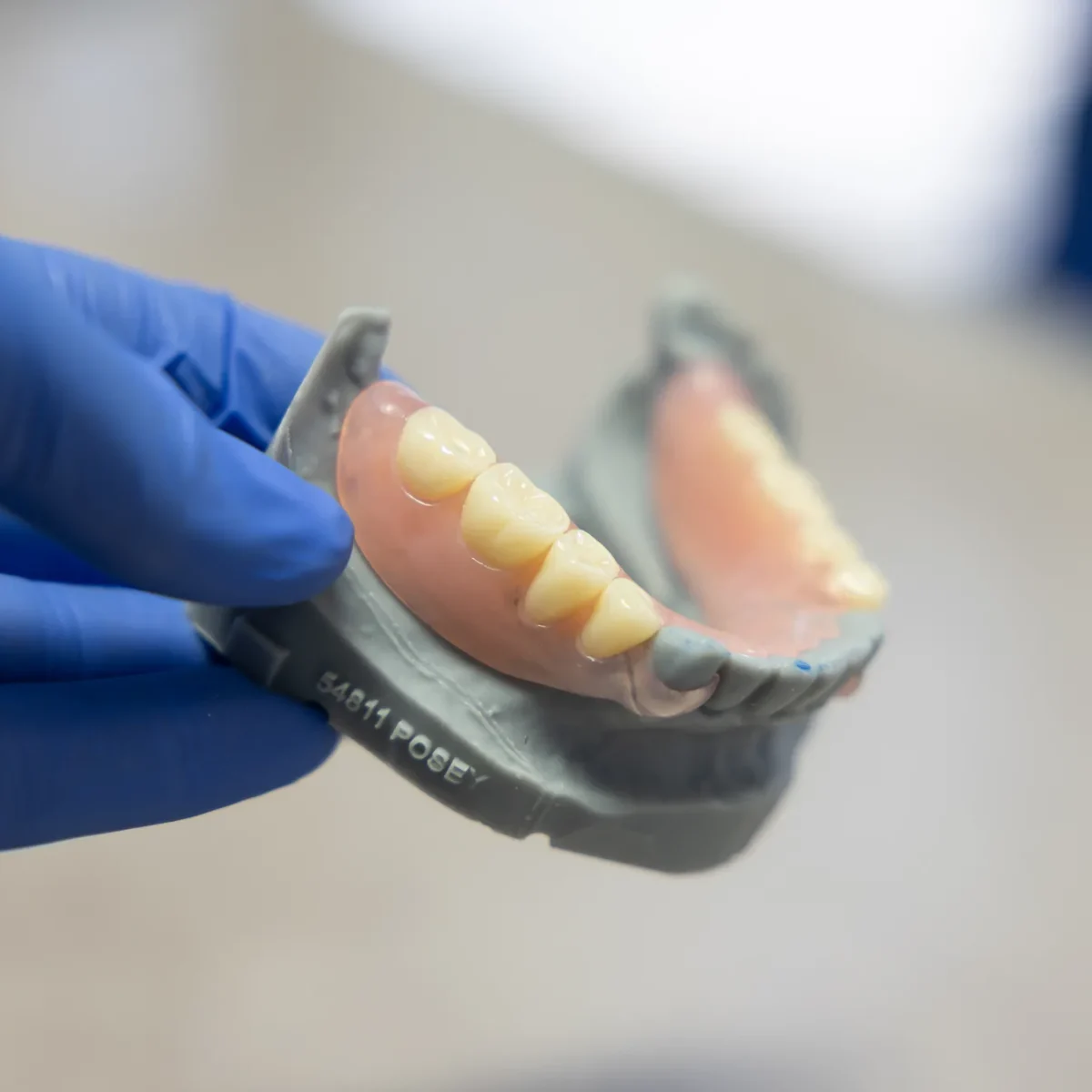 Complete denture esthetic frontal view