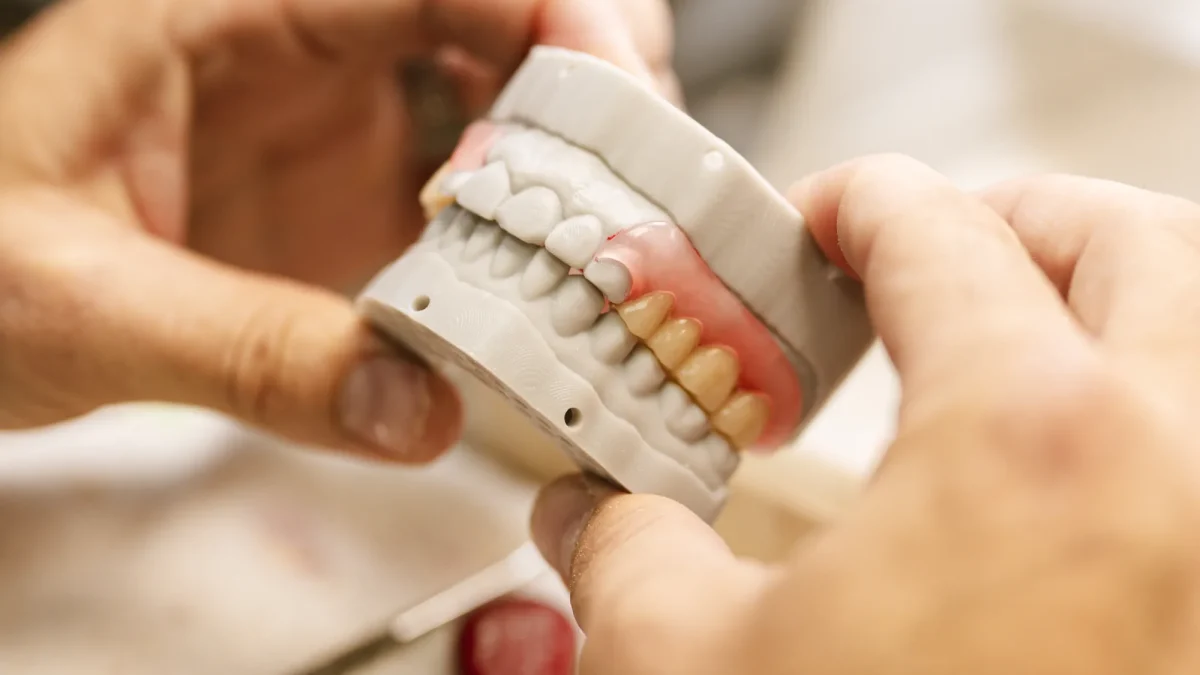 A Valplast flexible partial denture with thermoplastic clasps at the IDA bench