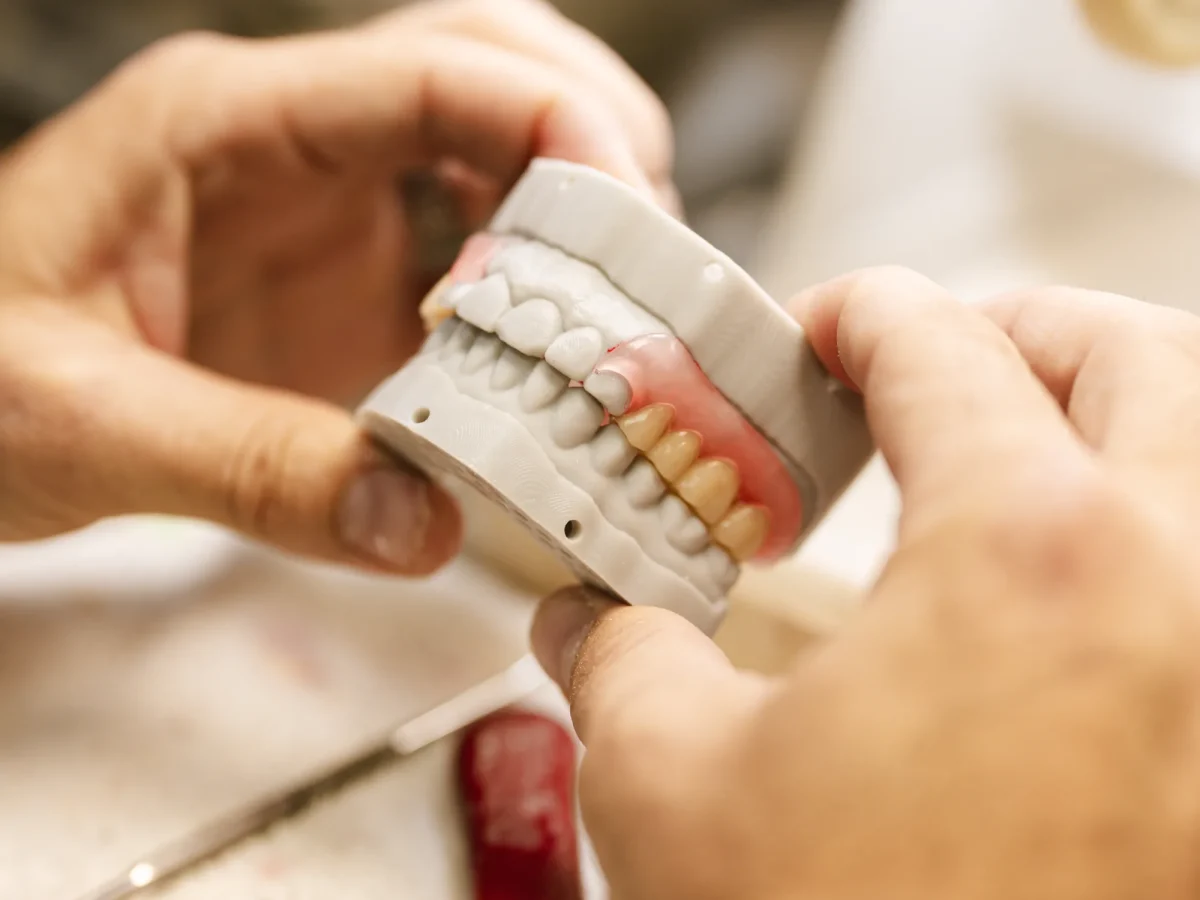 A Valplast flexible partial denture with thermoplastic clasps at the IDA bench
