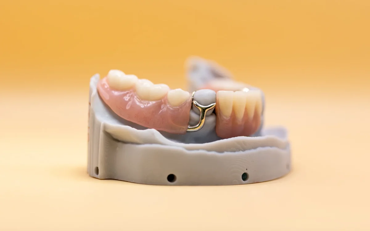 Flexible thermoplastic partial denture detail