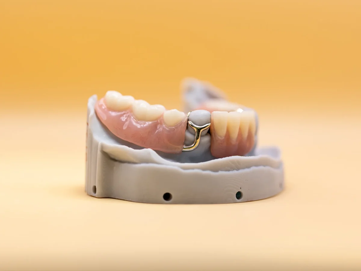 Flexible thermoplastic partial denture detail