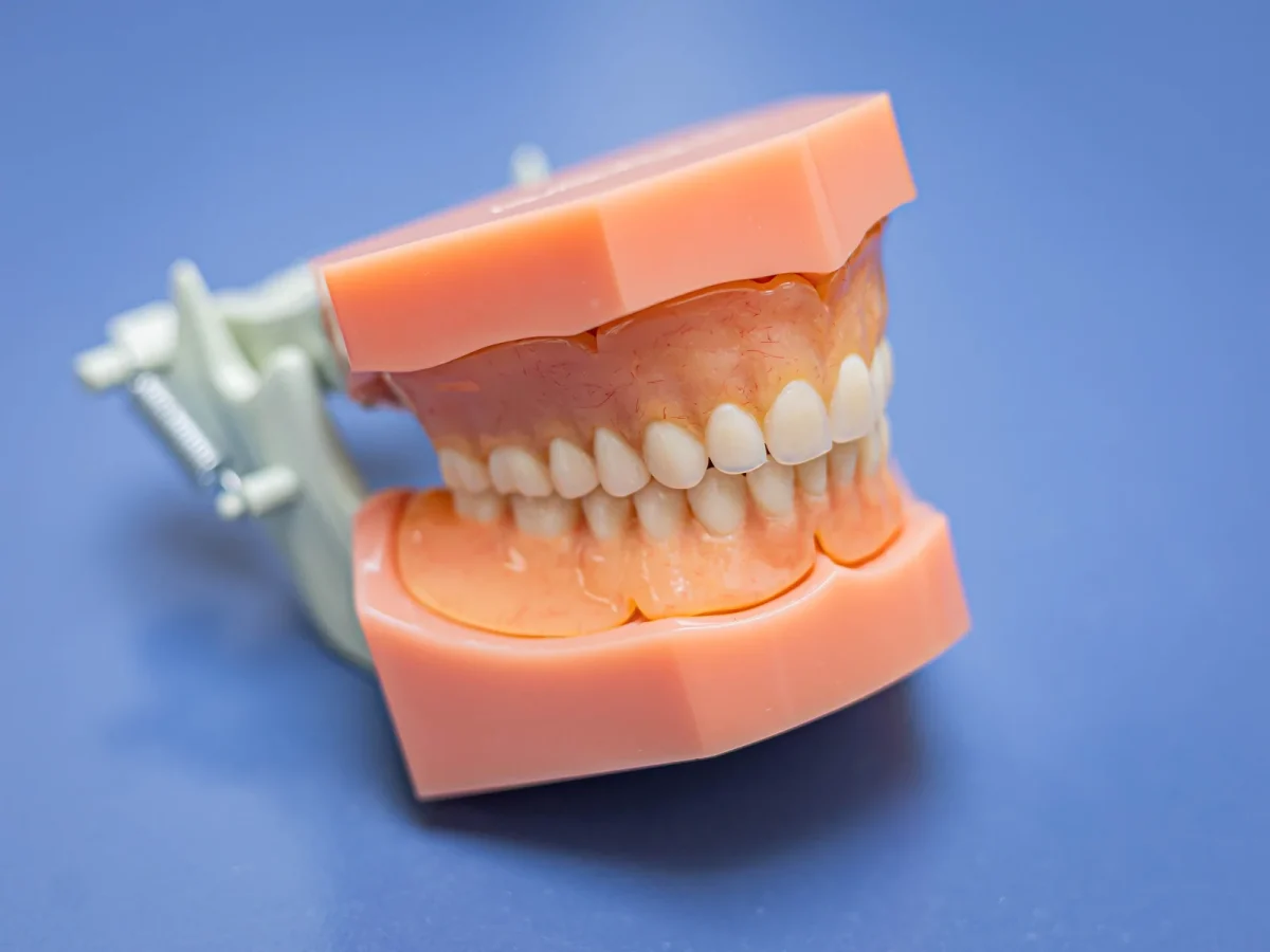Full upper and lower denture set on an articulator