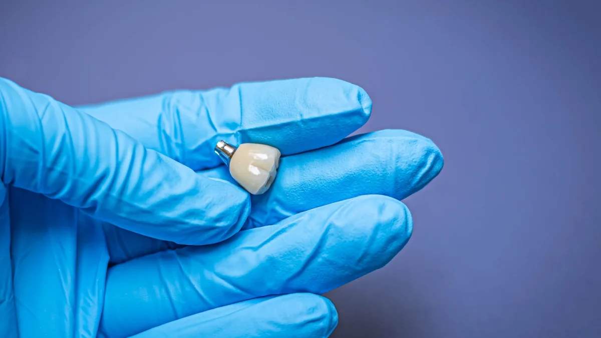 Implant crown seated on its abutment, the restoration margin visible at the junction