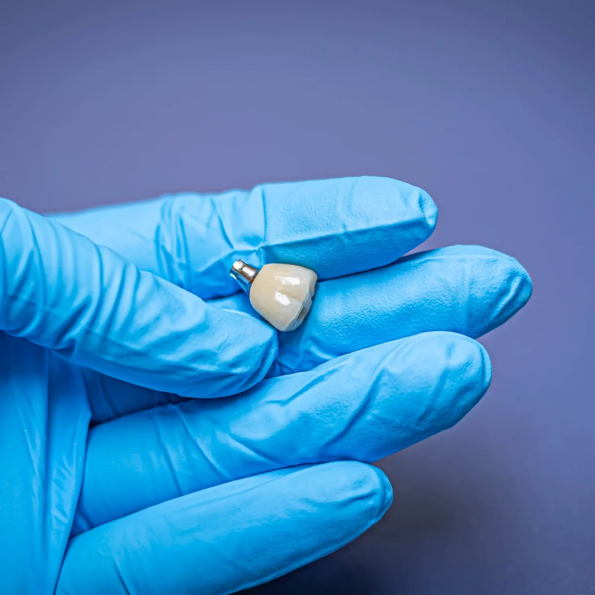 Implant crown on abutment held in a gloved hand