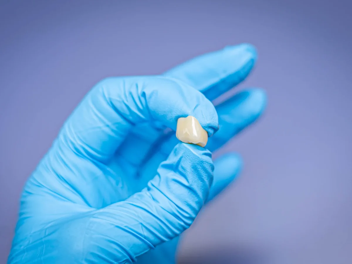 Single-unit zirconia crown held in a gloved hand