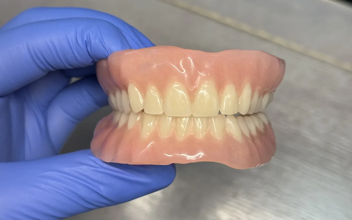 Lucitone digital complete denture set