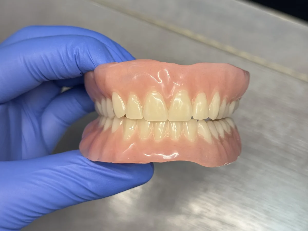 Lucitone digital complete denture set