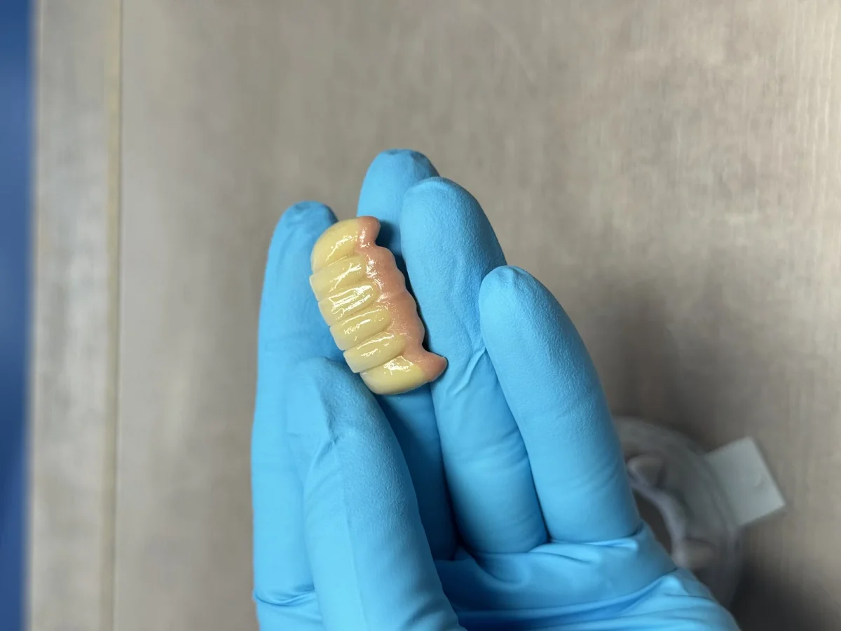 PFM bridge held in a gloved hand