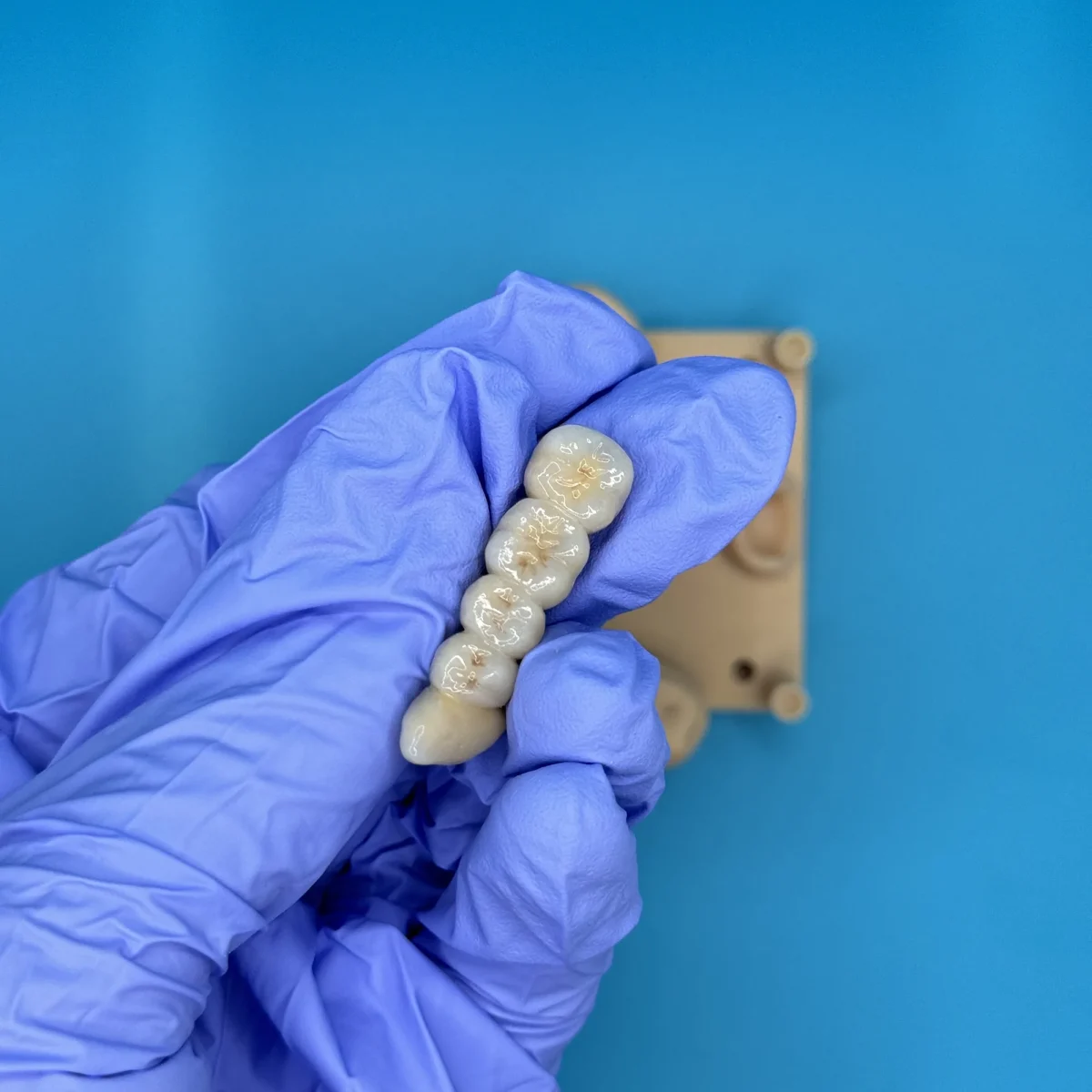 Occlusal guard at the IDA bench
