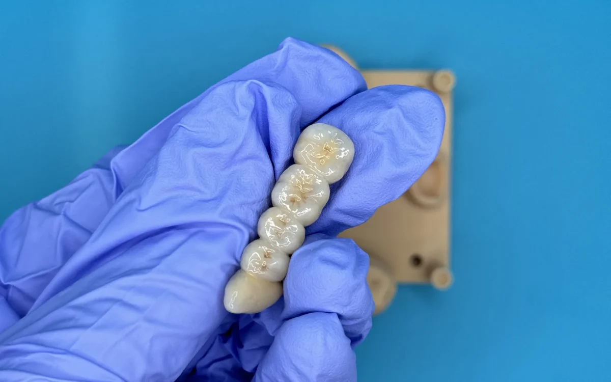 Occlusal guard at the IDA bench