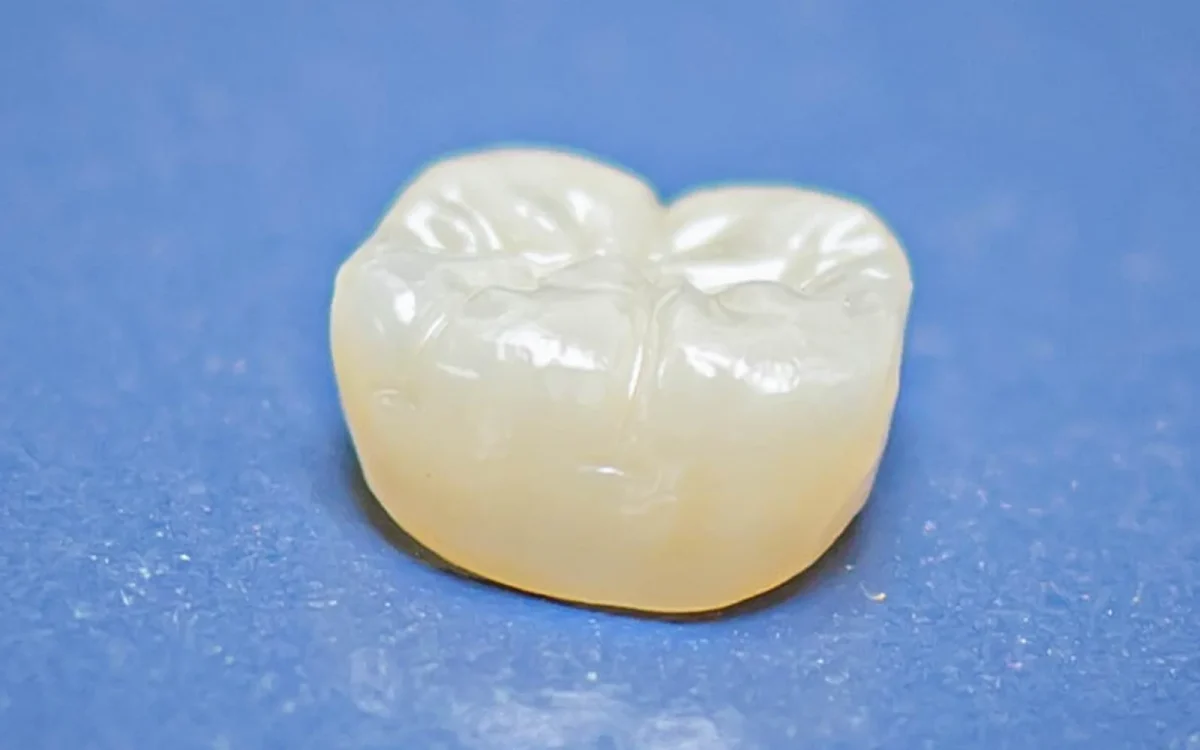 Single zirconia crown detail shot