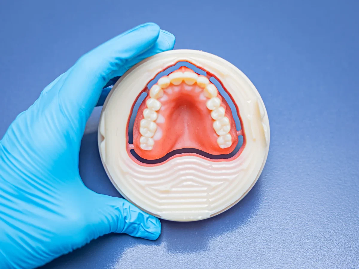 Two-color 3D printed denture base
