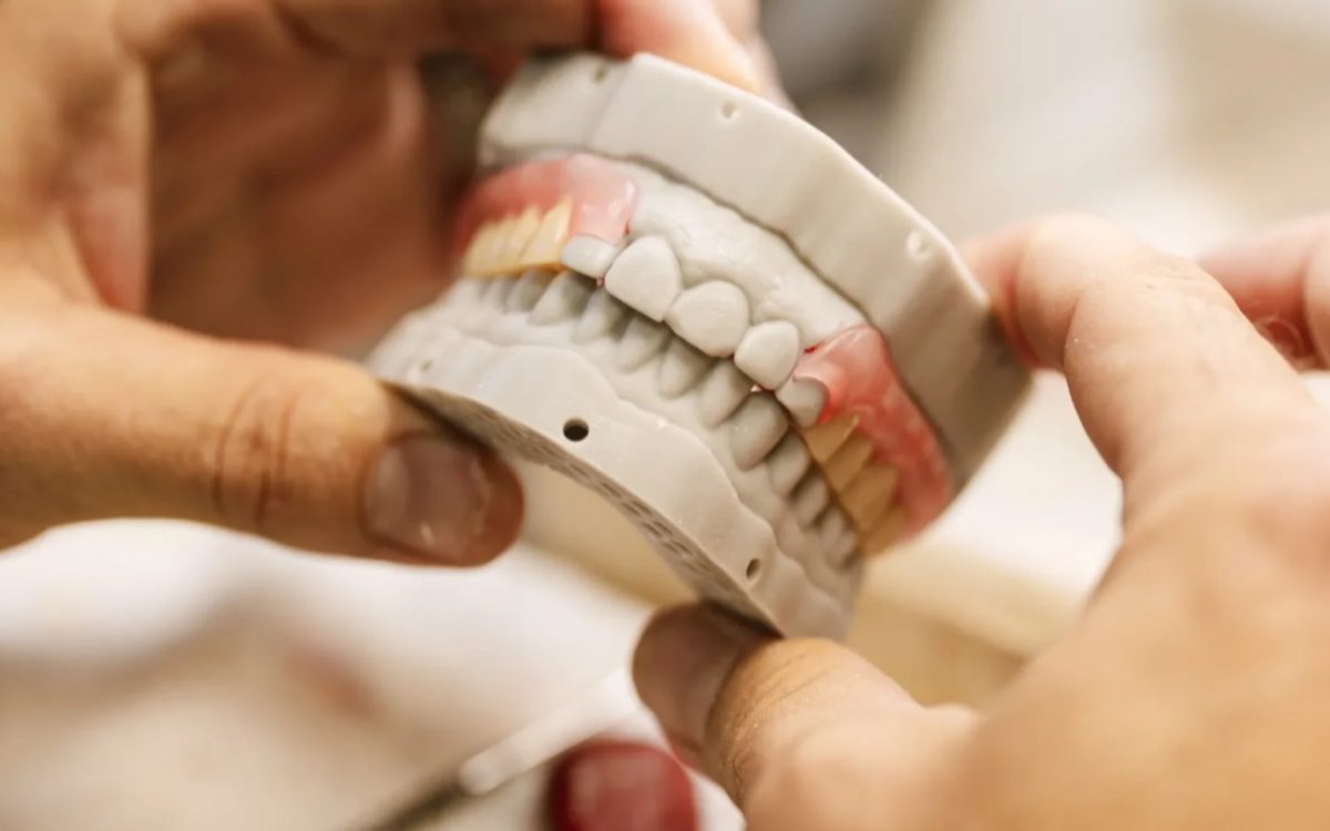 Articulated complete denture, upper and lower, at the IDA bench