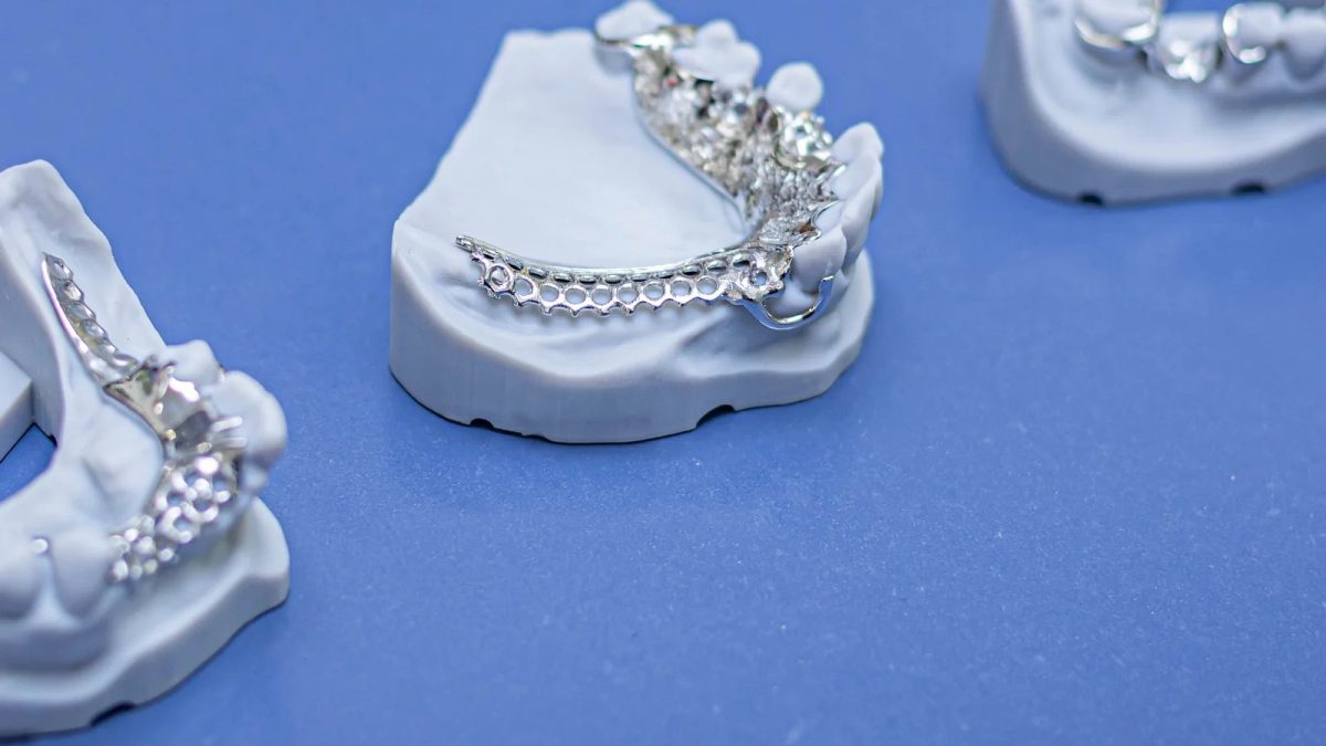 Three chrome cobalt cast partial denture frameworks on master casts, clasp arms visible, at the IDA bench