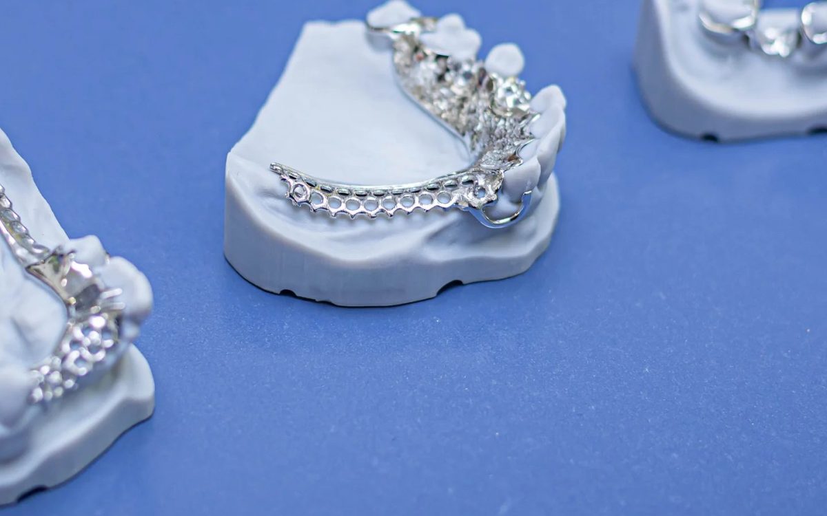 Three chrome cobalt cast partial denture frameworks on master casts, clasp arms visible, at the IDA bench