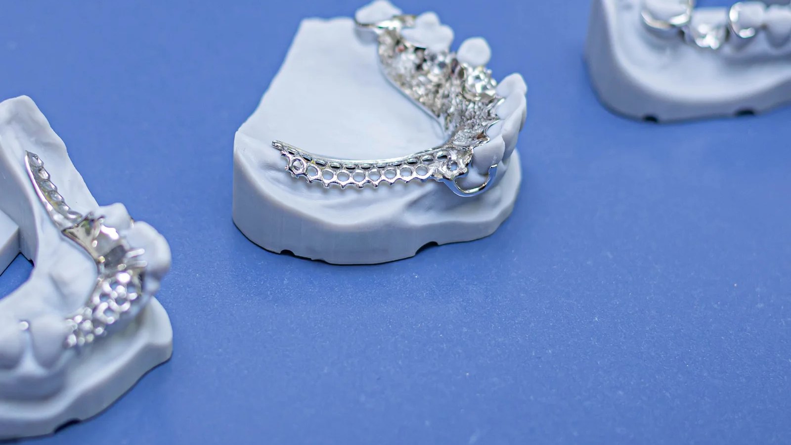 Three chrome cobalt cast partial denture frameworks on master casts at the IDA laboratory