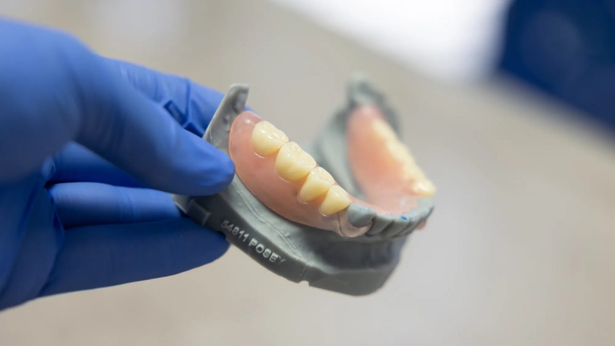 Complete denture, frontal esthetic view, at the IDA bench