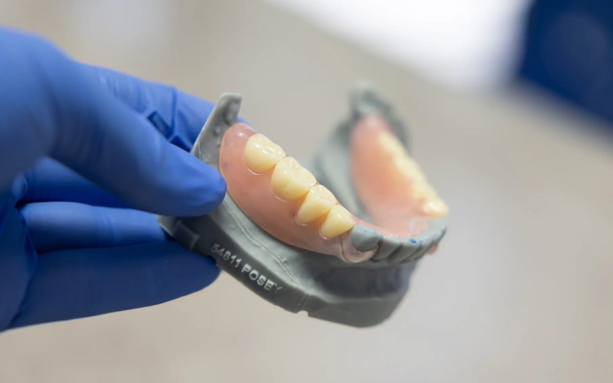 Complete denture, frontal esthetic view, at the IDA bench