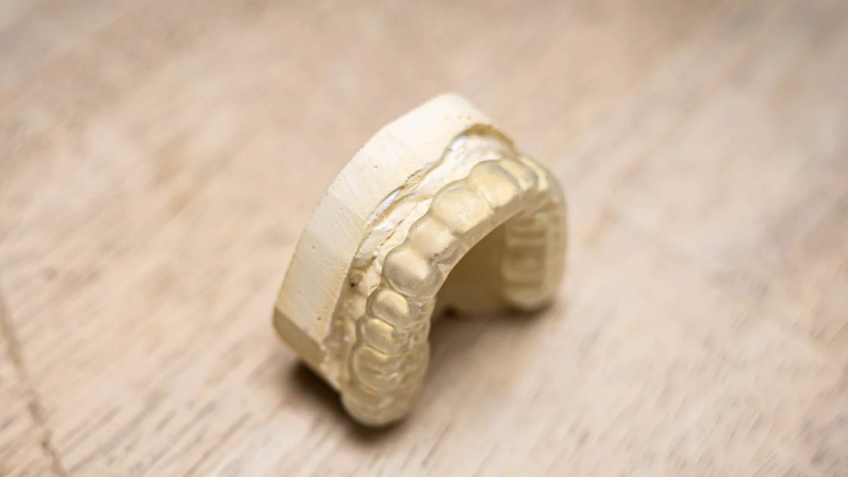 Hard full arch occlusal guard seated on a model on the bench at International Dental Arts
