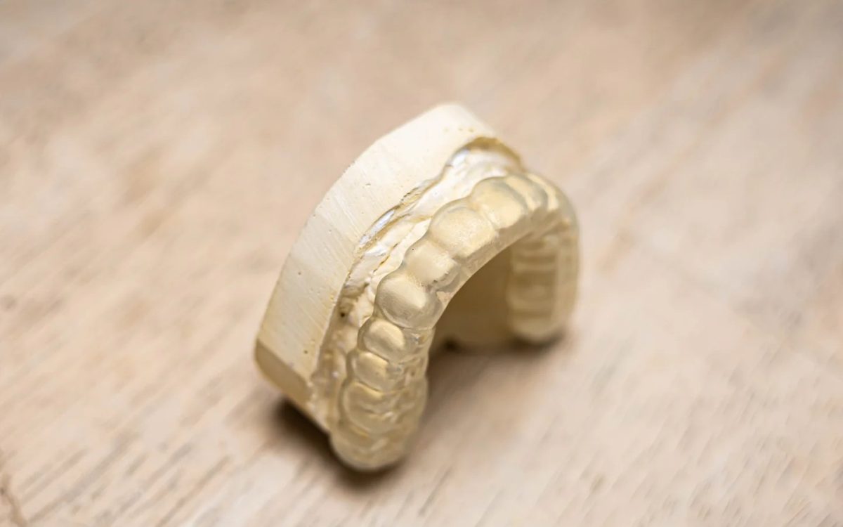 Hard full arch occlusal guard seated on a model on the bench at International Dental Arts