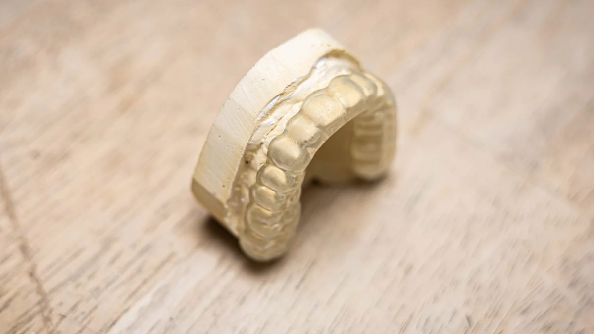 Clear hard acrylic occlusal splint on a model at the IDA bench