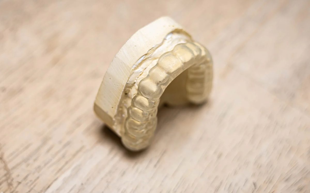 Clear hard acrylic occlusal splint on a model at the IDA bench