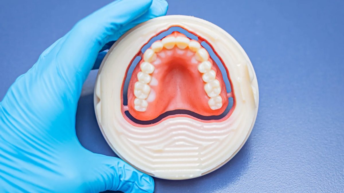 Two-colour printed denture base produced in the IDA digital department