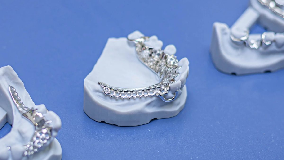 Chrome cobalt cast partial denture frameworks on master casts at the IDA bench