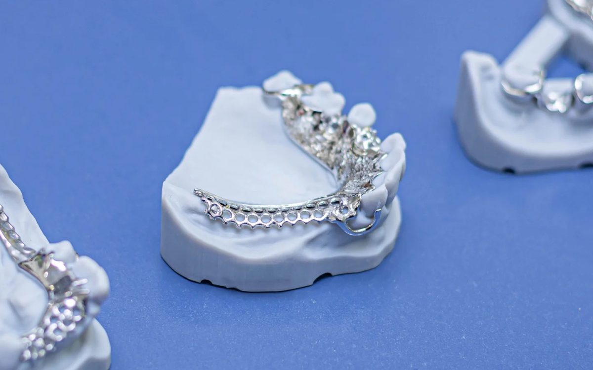 Chrome cobalt cast partial denture frameworks on master casts at the IDA bench
