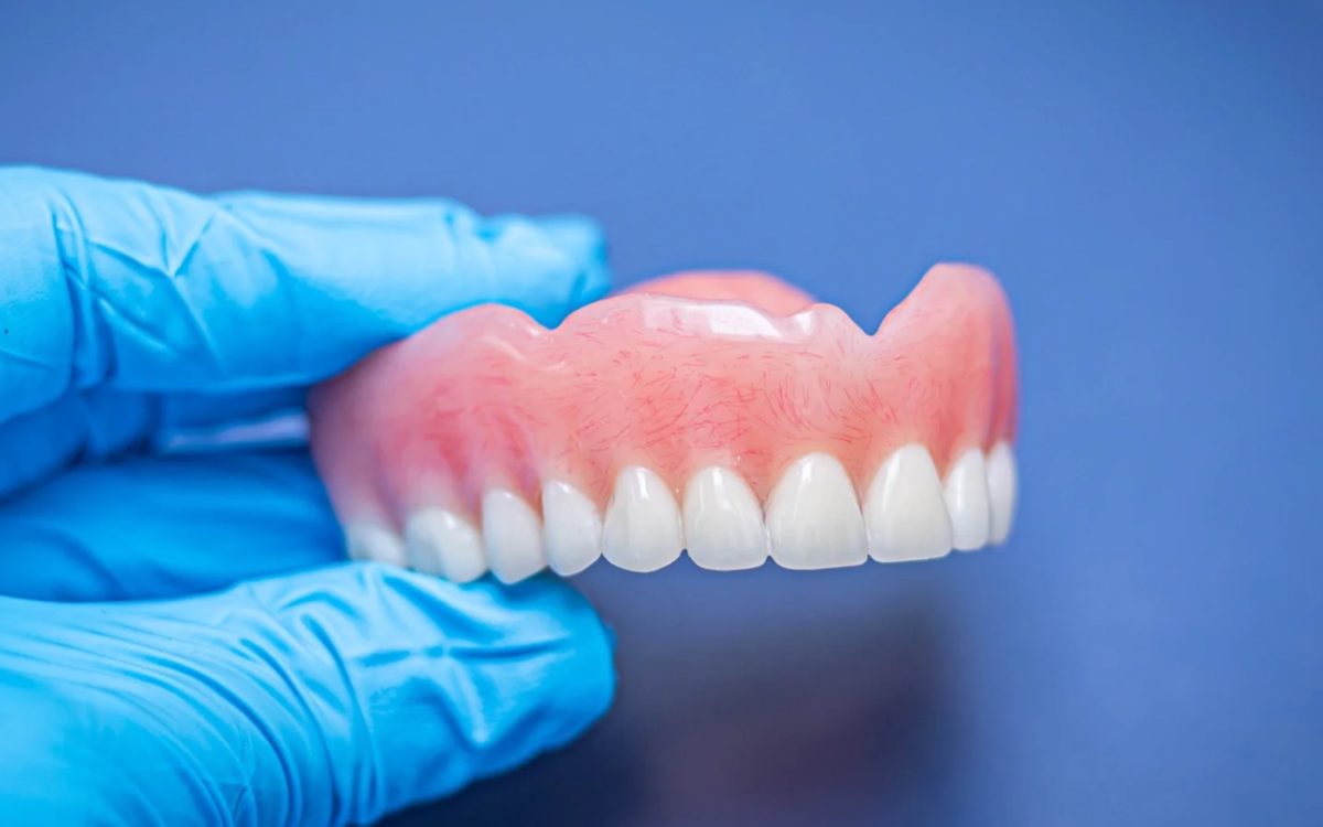 Finished upper complete denture held in a gloved hand