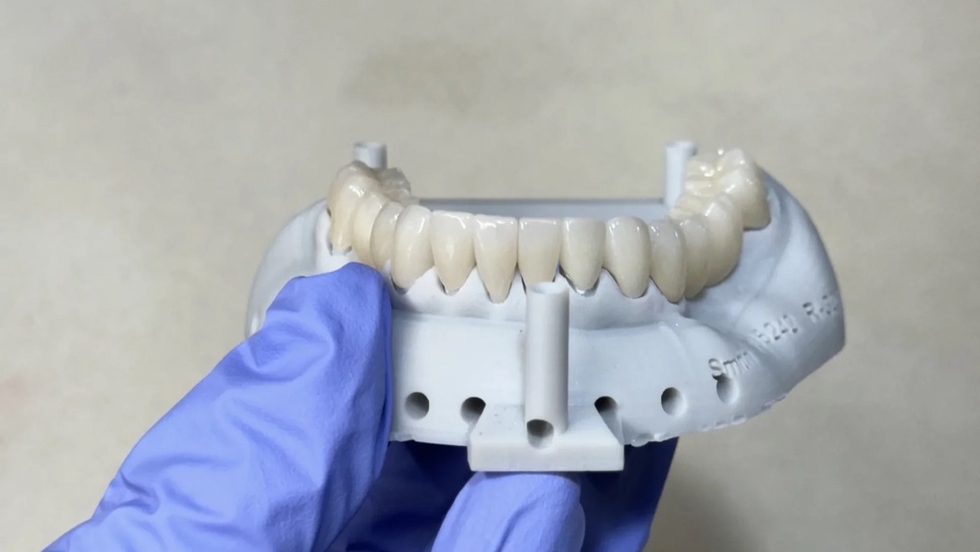 Full arch restoration on a printed model with the holders where each implant analog seats, at the IDA lab